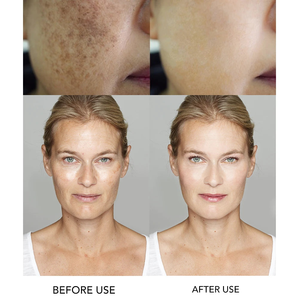 AILKE Brightening Day & Night Face Cream, Anti-Aging, Moisturizing, Lightening, Stains Remove Facial Skin Care Cosmetics
