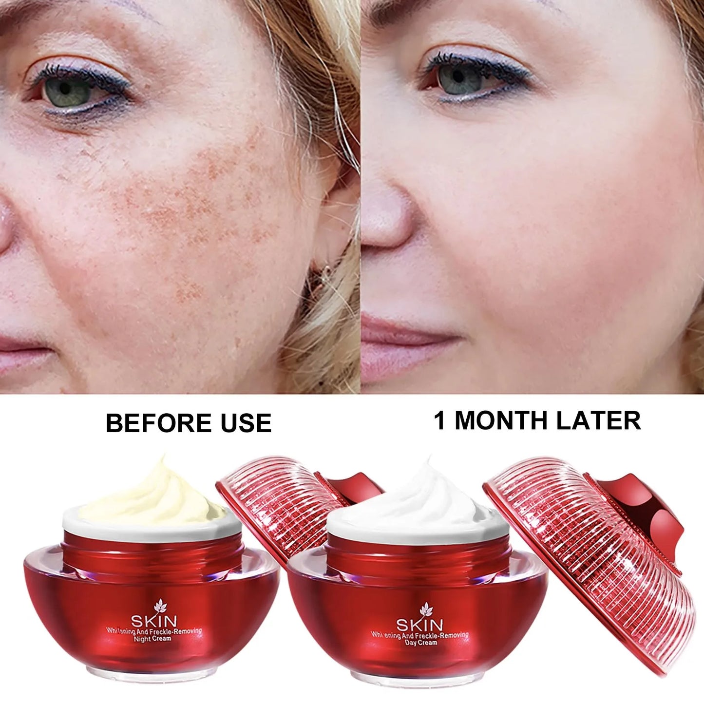 AILKE Brightening Day & Night Face Cream, Anti-Aging, Moisturizing, Lightening, Stains Remove Facial Skin Care Cosmetics
