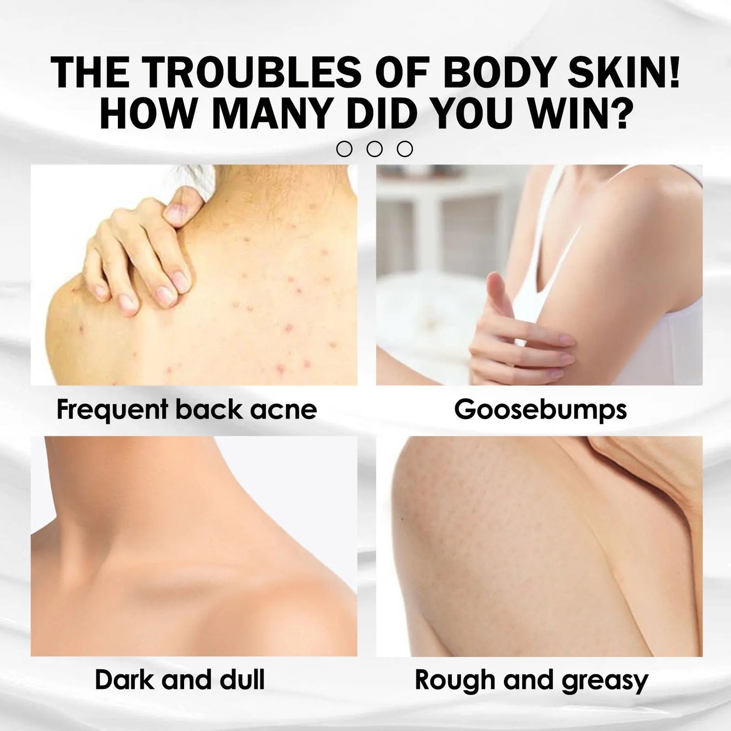 Moisturizing Cream Keratosis Follicle Pilaris Removal Shrink Pore Fade Pigmentation Whit-ening Smooth Repair Chicken Skin Cream