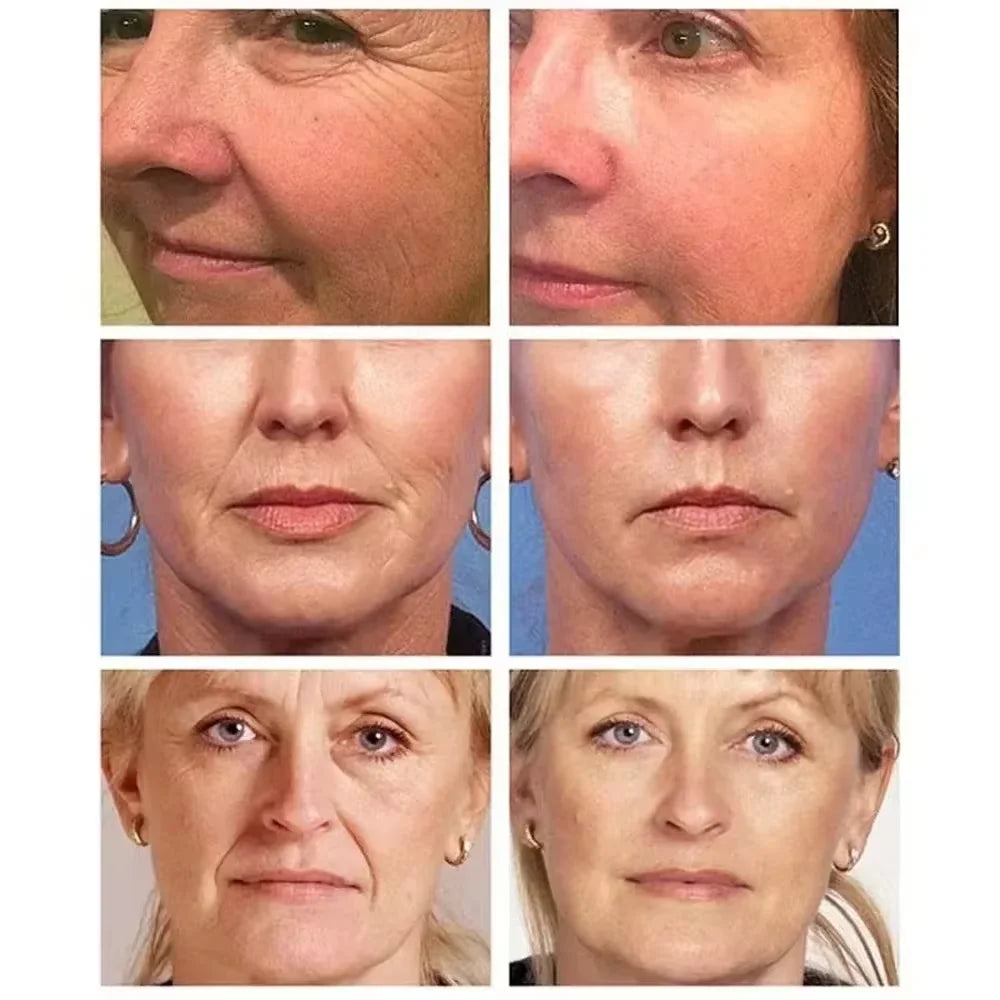 Retinol Wrinkle Removal Face Cream Anti-Aging Firming Lifting Fade Fine Lines Products Moisturizing Brighten Repair Skin Care