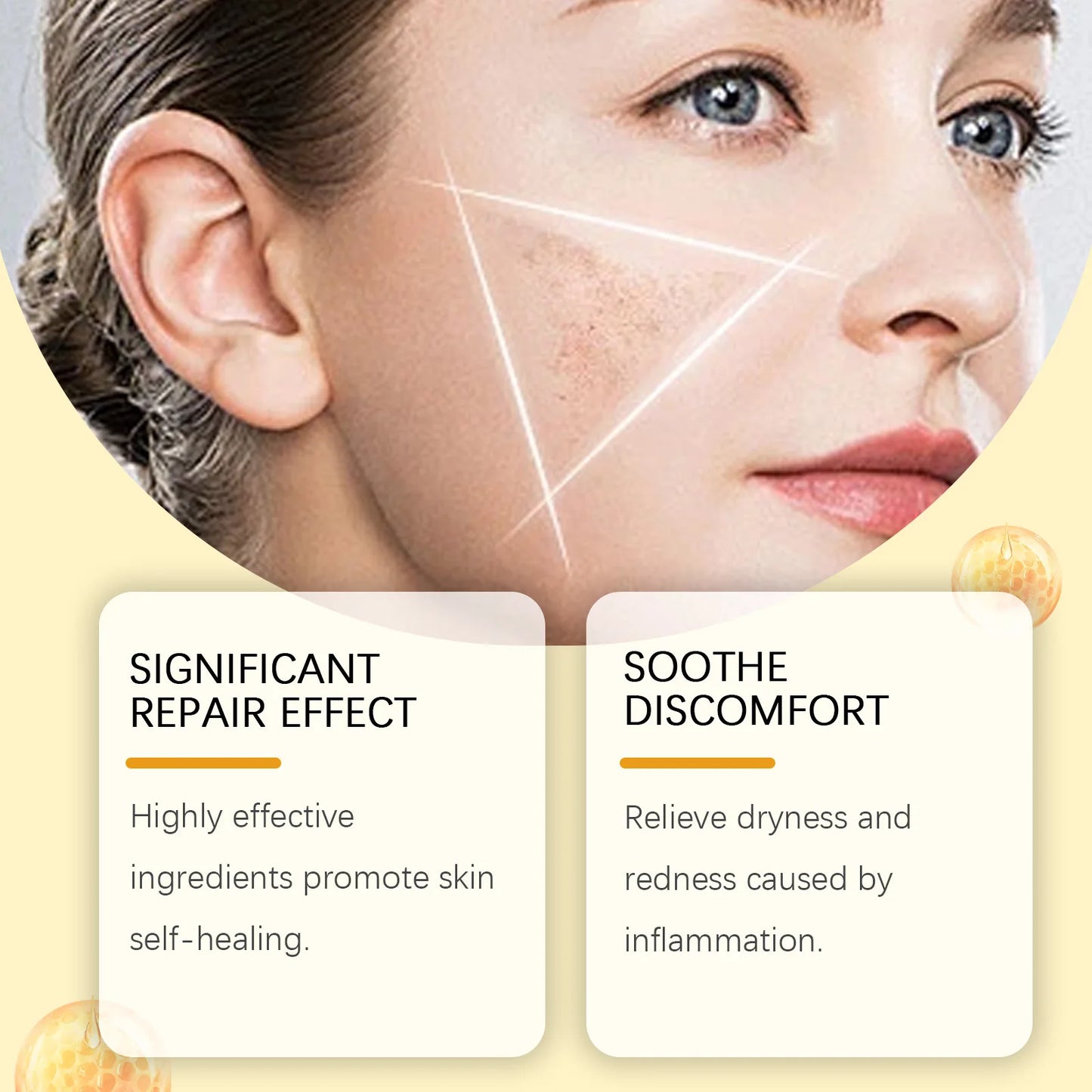 Bee Venom Cream for Sensitive Skin Care - Skin Barrier Repair Treatment Reduce Redness & Blemishes Skin Renewal Moisturizer 60g