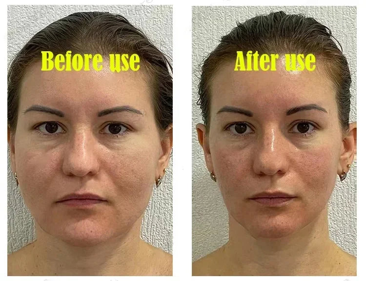 V-Shape Face Slimming Cream Remove Double Chins Firming Lifting Up V Cheek Fat Burning Anti-aging Shaping Massage Care Products