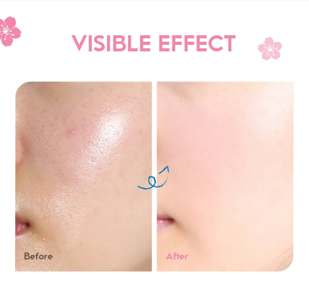 LAIKOU Sakura Hydrating Cream Moisturizer Whitening Nourishing Oil Control Moisturizing Repairing Deep Hydration Winter Skincare