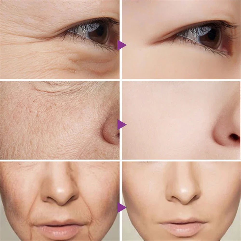 Retinol Wrinkle Removal Face Cream Anti-Aging Firming Lifting Fade Fine Lines Products Moisturizing Brighten Repair Skin Care